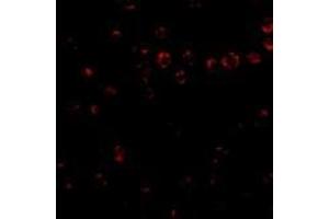 Immunofluorescence of Integrin alpha 4 in Jurkat cells with AP30435PU-N Integrin alpha 4 antibody at 2 μg/ml. (ITGA4 抗体  (Center))
