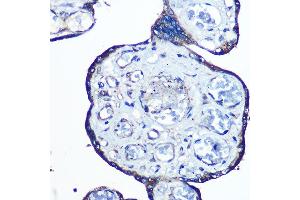 Immunohistochemistry of paraffin-embedded human placenta using N-WASP/N-WASP/WASL Rabbit mAb (ABIN7268856) at dilution of 1:100 (40x lens). (Neural Wiskott-Aldrich syndrome protein (WASL) 抗体)
