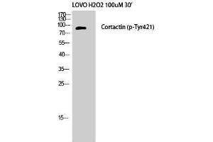 Western Blotting (WB) image for anti-Cortactin (CTTN) (pTyr421) antibody (ABIN3179420) (Cortactin 抗体  (pTyr421))