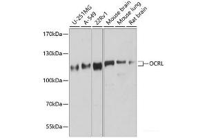 Western blot analysis of extracts of various cell lines using OCRL Polyclonal Antibody at dilution of 1:1000. (OCRL 抗体)