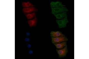 ABIN7093224, ABIN7097235 and ABIN7097236 staining HepG2 cells(30 min of 4uM Forskolin treatment) by IF/ICC. (VWF 抗体  (Internal Region))