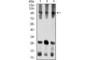 Western blot analysis using ATXN1 mouse mAb against COS7 (1), NIH/3T3 (2), and HL-60 (3) cell lysate. (Ataxin 1 抗体  (AA 645-815))