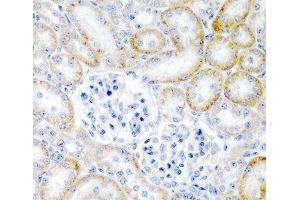 Immunohistochemistry of paraffin-embedded Rat kidney using RLN2 Polyclonal Antibody at dilution of 1:200 (40x lens). (Relaxin 2 抗体)