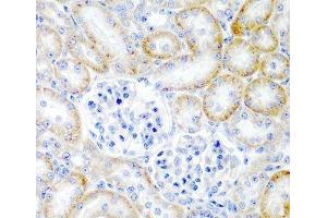 Immunohistochemistry of paraffin-embedded Rat kidney using RLN2 Polyclonal Antibody at dilution of 1:200 (40x lens). (Relaxin 2 抗体)