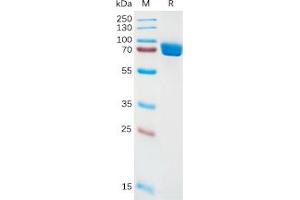 Human IL1RA Protein, hFc Tag on SDS-PAGE under reducing condition. (IL1RN Protein (Fc Tag))
