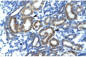 Rabbit Anti-FLJ14768 Antibody Catalog Number: ARP30009 Paraffin Embedded Tissue: Human Kidney Cellular Data: Epithelial cells of renal tubule Antibody Concentration: 4. (FIZ1 抗体  (C-Term))