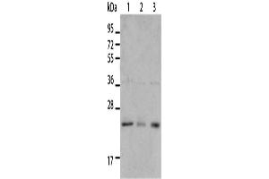 Western Blotting (WB) image for anti-BCL2/adenovirus E1B 19kDa Interacting Protein 1 (BNIP1) antibody (ABIN2421093)