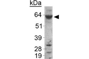 Western blot analysis of PLIN1 in human liver samples with PLIN1 polyclonal antibody . (PLIN1 抗体  (AA 450-522))