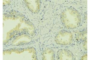 ABIN6278425 at 1/100 staining Mouse colon tissue by IHC-P. (ATP7A 抗体  (C-Term))