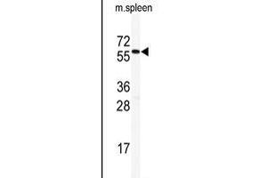 Western blot analysis of anti-HDAC2 Antibody (C-term) (ABIN6242378 and ABIN6577318) in mouse spleen tissue lysates (35 μg/lane).