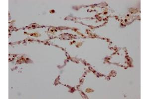 IHC image of ABIN7127313 diluted at 1:100 and staining in paraffin-embedded human lung tissue performed on a Leica BondTM system. (Recombinant ALOX5 抗体)