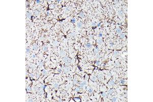 Immunohistochemistry (IHC) image for anti-Glial Fibrillary Acidic Protein (GFAP) antibody (ABIN7267389)