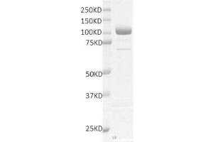 Recombinant LSD1 / KDM1A protein gel.