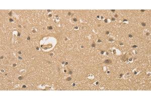 Immunohistochemistry of paraffin-embedded Human brain using ALDH8A1 Polyclonal Antibody at dilution of 1:30 (ALDH8A1 抗体)