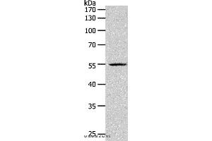Western blot analysis of K562 cell, using PAX1 Polyclonal Antibody at dilution of 1:1200 (PAX1 抗体)