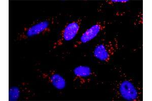 Proximity Ligation Analysis of protein-protein interactions between APPL1 and PIK3CA.