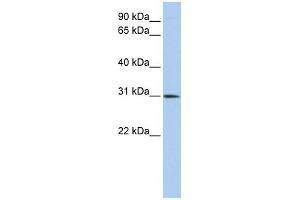 WB Suggested Anti-DLX1 Antibody Titration:  0. (DLX1 抗体  (C-Term))