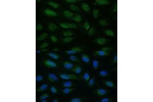 Immunofluorescence analysis of U-2 OS cells using HIBCH antibody (ABIN7265331) at dilution of 1:100. (HIBCH 抗体  (AA 33-330))