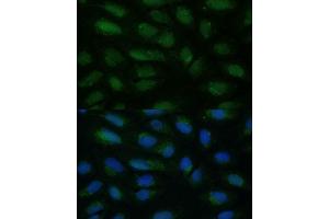 Immunofluorescence analysis of U-2 OS cells using HIBCH antibody (ABIN7265331) at dilution of 1:100. (HIBCH 抗体  (AA 33-330))