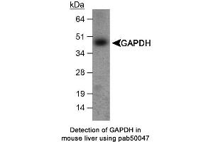 Image no. 1 for anti-Glyceraldehyde-3-Phosphate Dehydrogenase (GAPDH) antibody (ABIN363356) (GAPDH 抗体)