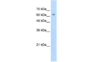 WB Suggested Anti-ZNF274 Antibody Titration: 2. (ZNF274 抗体  (N-Term))