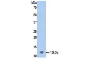 Detection of recombinant VTN using Polyclonal Antibody to Vitronectin (VTN) (Vitronectin 抗体  (AA 400-468))