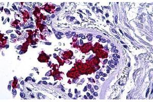 Human Lung: Formalin-Fixed, Paraffin-Embedded (FFPE) (MUC5AC 抗体)