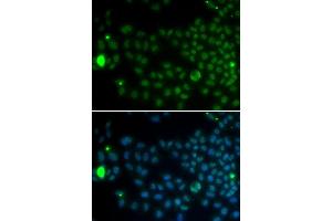Immunofluorescence analysis of MCF7 cell using SPDYA antibody. (SPDYA 抗体  (AA 1-313))