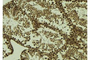 ABIN6273637 at 1/100 staining Mouse testis tissue by IHC-P. (HSPB9 抗体  (C-Term))