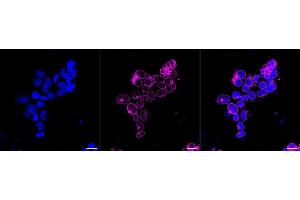 Immunocytochemical staining of HeLa cells with RANGAP1 antibody (ABIN7800128), 1:1,000).