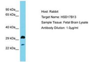 Image no. 1 for anti-Hydroxysteroid (17-Beta) Dehydrogenase 13 (HSD17B13) (AA 91-140) antibody (ABIN6750566) (HSD17B13 抗体  (AA 91-140))