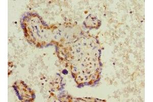 Immunohistochemistry of paraffin-embedded human placenta tissue using ABIN7163046 at dilution of 1:100 (PHF11 抗体  (AA 1-292))