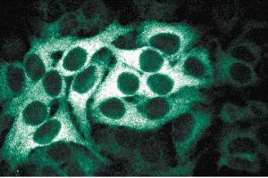 Immunofluorescence staining of HeLa cells (Human cervical epitheloid carcinoma, ATCC CCL-2. (BUB1B 抗体  (AA 276-388))