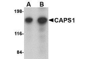 Western blot analysis of CAPS1 in rat brain tissue lysate with AP30179PU-N CAPS1 antibody at (A) 0. (CADPS 抗体  (N-Term))