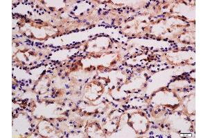 Formalin-fixed and paraffin embedded human kidney labeled with Rabbit Anti-phospho-PRKD3(Ser41) Polyclonal Antibody, Unconjugated  at 1:200 followed by conjugation to the secondary antibody and DAB staining (PRKD3 抗体  (pSer41))