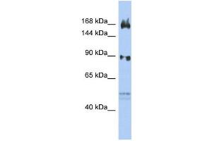 WB Suggested Anti-AFF2  Antibody Titration: 0. (AFF2 抗体  (N-Term))