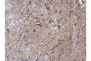 IHC-P Image NDUFV2 antibody detects NDUFV2 protein at mitochondria on mouse fore brain by immunohistochemical analysis. (NDUFV2 抗体  (Center))