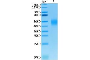 SDS-PAGE (SDS) image for V-Set Domain Containing T Cell Activation Inhibitor 1 (VTCN1) (AA 33-191) protein (His tag) (ABIN7273973)