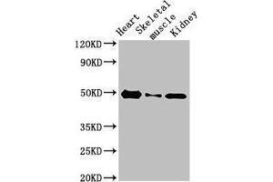 Western Blotting (WB) image for anti-ATPase, H+ Transporting, Lysosomal 42kDa, V1 Subunit C2 (ATP6V1C2) (AA 190-262) antibody (ABIN7175236)