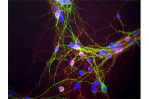 Mixed neuron-glial cultures stained with SNCA monoclonal antibody, clone 2A7 , our monoclonal antibody to SNCA (red) and chicken polylclonal antibody to MAP2 (green). (SNCA 抗体)