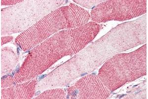 Human Skeletal Muscle (formalin-fixed, paraffin-embedded) stained with ARSB antibody ABIN337028 at 5 ug/ml followed by biotinylated anti-goat IgG secondary antibody ABIN481715, alkaline phosphatase-streptavidin and chromogen. (Arylsulfatase B 抗体  (AA 359-372))