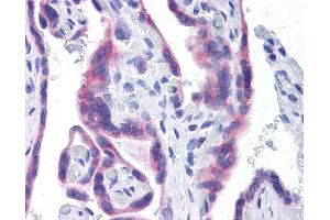 Anti-STT3A antibody IHC of human placenta. (STT3A 抗体  (AA 603-702))