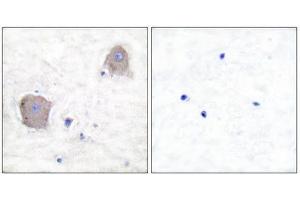 Immunohistochemistry (IHC) image for anti-Glutamate Receptor, Metabotropic 4 (GRM4) (C-Term) antibody (ABIN1848572) (Metabotropic Glutamate Receptor 4 抗体  (C-Term))