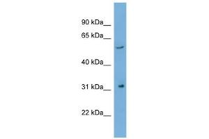 WB Suggested Anti-REM1 Antibody Titration: 0. (REM1 抗体  (N-Term))