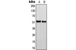 Western blot analysis of RGMB expression in HEK293T (A), NIH3T3 (B), H9C2 (C) whole cell lysates. (RGMB 抗体  (Center))