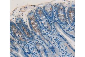 Used in DAB staining on fromalin fixed paraffin- embedded Kidney tissue (IGFBP4 抗体  (AA 22-254))
