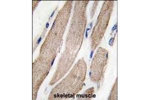 Forlin-fixed and paraffin-embedded hun skeletal muscle tissue reacted with P2K5 Antibody  f , which was peroxidase-conjugated to the secondary antibody, followed by DAB staining. (MAP2K5 抗体  (AA 127-156))