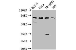 Western Blot Positive WB detected in: MCF-7 whole cell lysate, Hela whole cell lysate, SH-SY5Y whole cell lysate, U87 whole cell lysate All lanes: IL1RAPL1 antibody at 5. (IL1RAPL1 抗体  (AA 564-679))