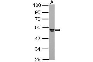 Western Blotting (WB) image for anti-Fibrinogen gamma Chain (FGG) antibody (ABIN2856626)