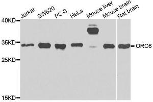Western blot analysis of extracts of various cell lines, using ORC6 antibody. (ORC6 抗体  (AA 1-252))
